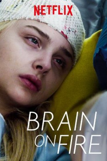 Brain on Fire